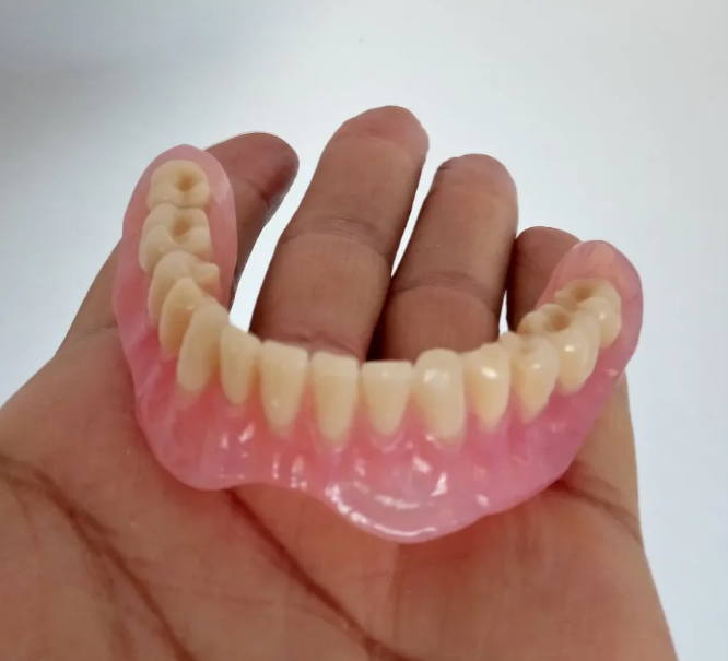 Prótesis dental removible inferior terminada en el Laboratorio Dental A.G.